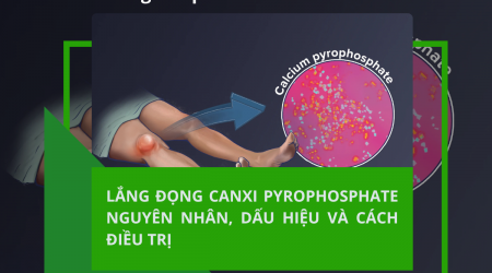 LẮNG ĐỌNG CANXI PYROPHOSPHATE: NGUYÊN NHÂN, DẤU HIỆU VÀ CÁCH ĐIỀU TRỊ